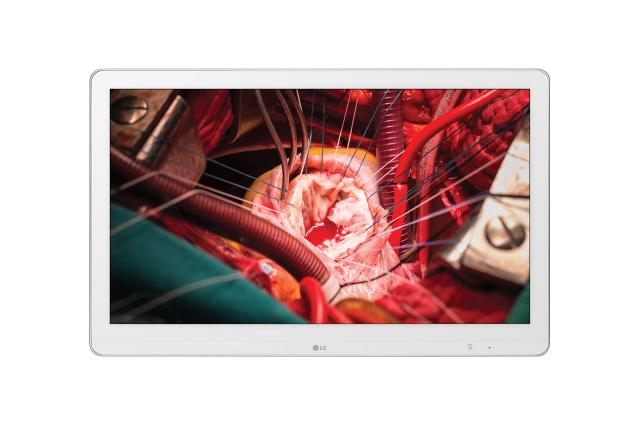 Медицински дисплей LG 27HK510S-W, 27" (68.58 см) Full HD, HDMI(1.4) x 1, S-Video x 1, 3G-SDI x 1, DVI-I x 1 